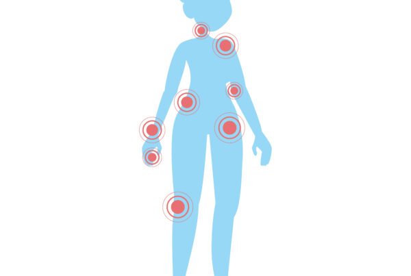 dolori muscolari diffusi associati ad affaticamento, rigidità, insonnia e alterazioni dell'umore.