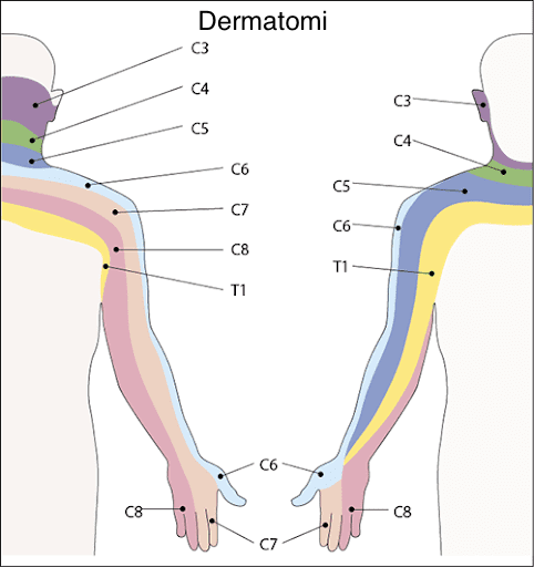 dolore Sintomi della cervicobrachialgia e dolore al braccio