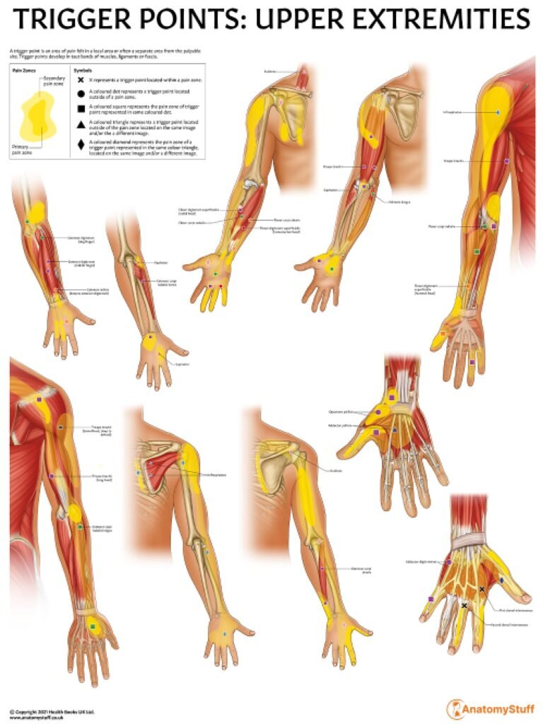 Sintomi della cervicobrachialgia e dolore al braccio.